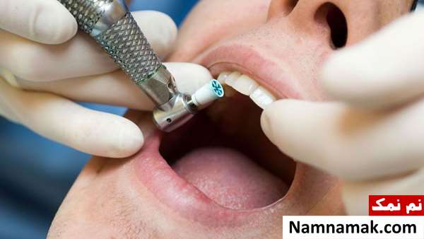 علت بی حس شدن سقف دهان چیست؟