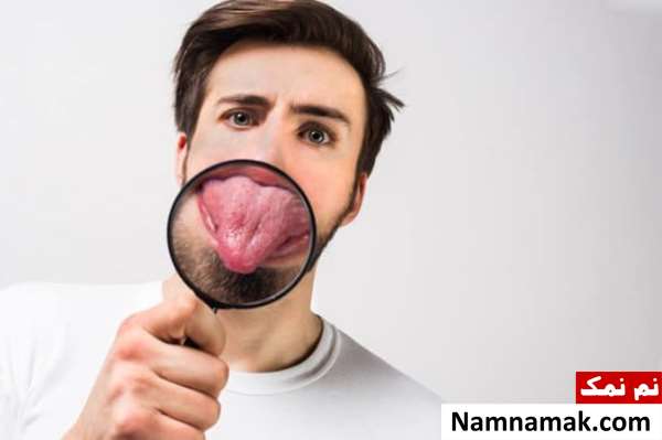 بی حس شدن زبان و لب