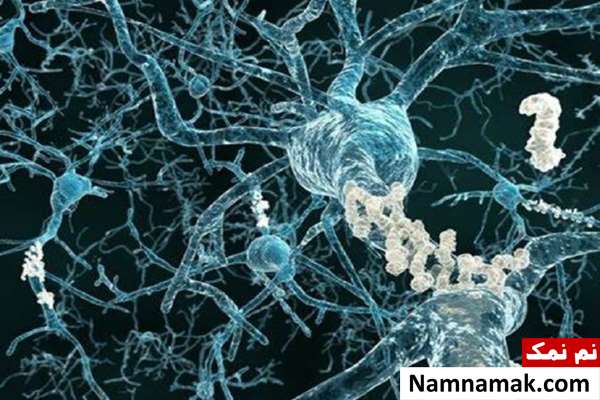 مقابله با آلزایمر به کمک نانوپاک کننده ها