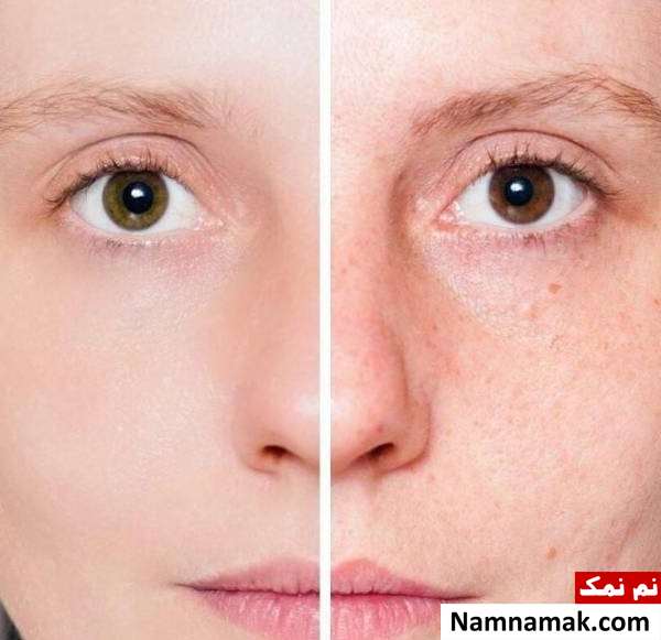 سابسیژن کسانی که نباید سابسیژن کنند