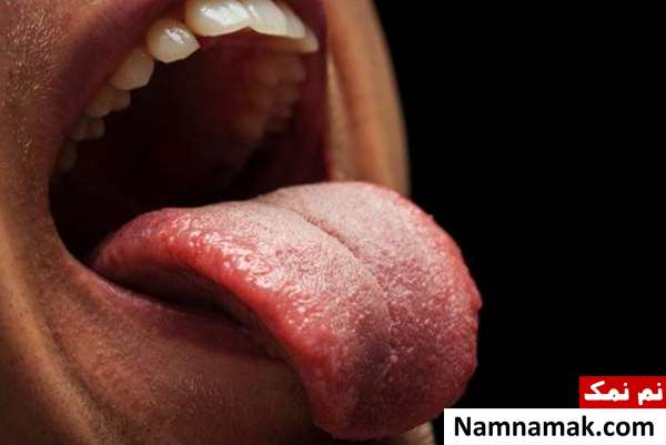 علت باردار شدن زبان
