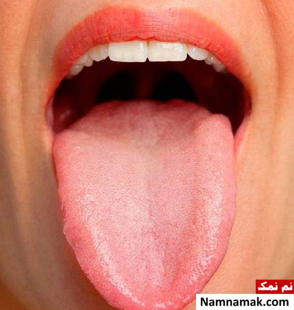بار زبان چیست و درمان آن چگونه است؟