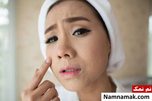 تشخیص پوست حساس راه های تشخیص انواع پوست