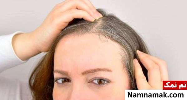 دلایل سفیدی زودرس موهای سر چیست؟