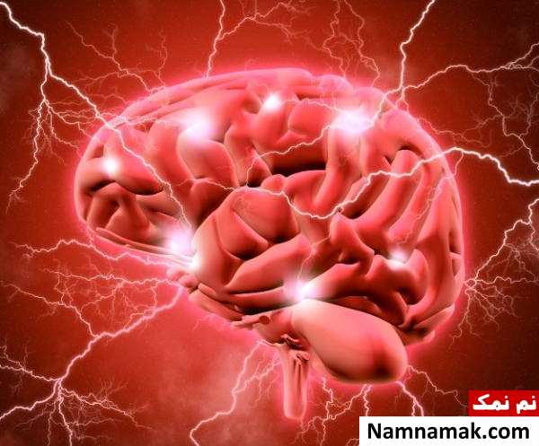آنوریسم مغزی آنوریسم مغزی از علل فشار داخل سر
