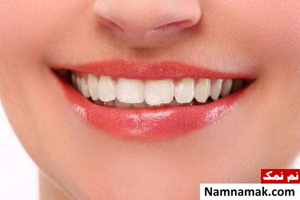 پوسیدگی دندان پوسیدگی دندان از مضرات مصرف لیمو با چای