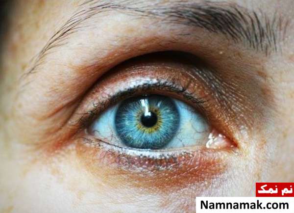 معاینه چشم چگونه چشم هایمان را در خانه معاینه کنیم؟