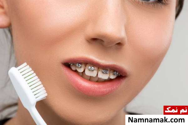 روش های زیبایی دندان