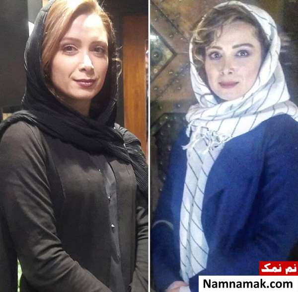 فرناز رهنما فرناز رهنما عمل بینی