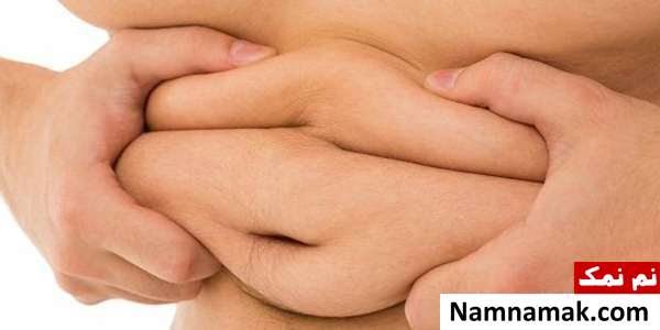 افتادگی پوست عوامل تاثیر گذار بر افتادگی پوست