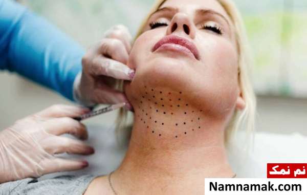 روش های از بین بردن غبغب