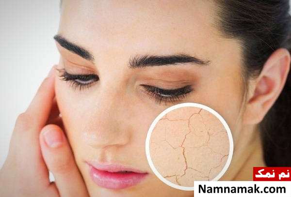 بهترین روش های لایه برداری پوست
