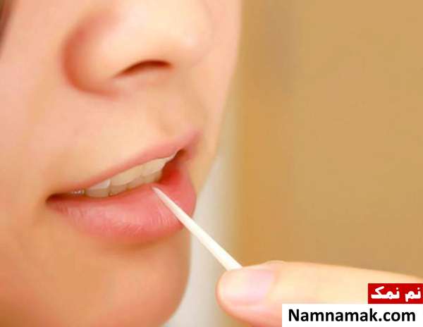 عوارض استفاده از خلال دندان