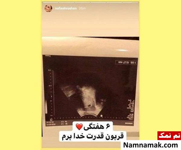 عکسی از سونوگرافی نفیسه روشن
