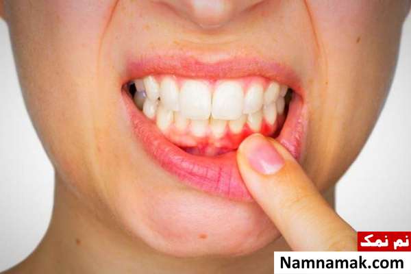 بهترین دهانشویه طبیعی