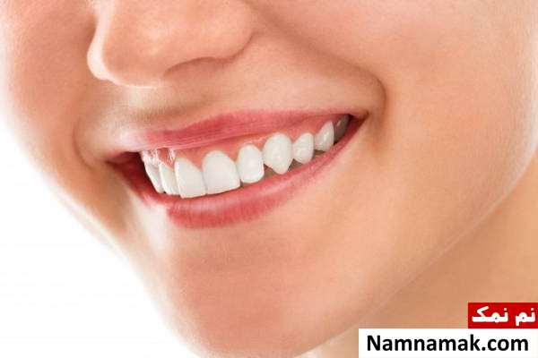 اصلاح لبخند لثه ای با لیزر 