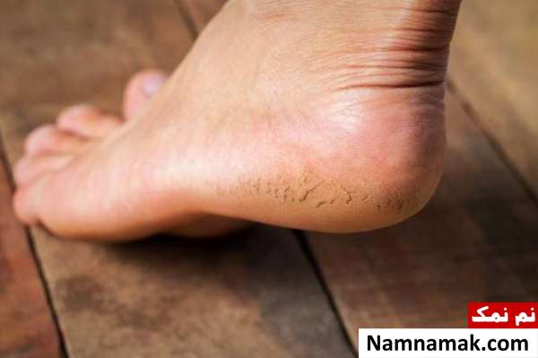 نکات بهداشتی مراقبت از پاها