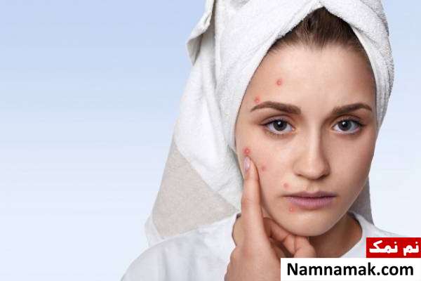 مشکلات پوست از عوارض تغذیه ناسالم