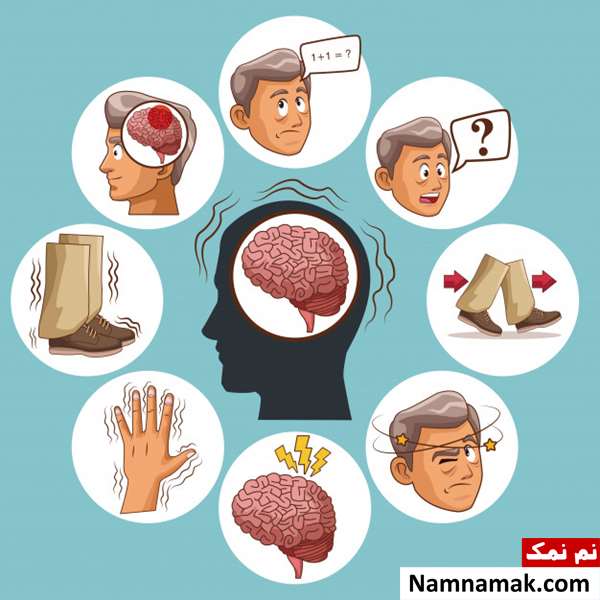 بیماری شبه پارکینسون یا پارکینسونیسم بیماری پارکینسونیسم