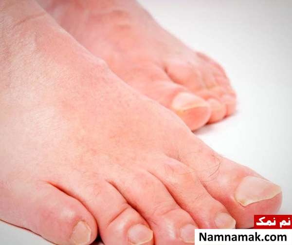 تشخیص سلامت داخلی بدن علائم عفونت پنهان در بدن