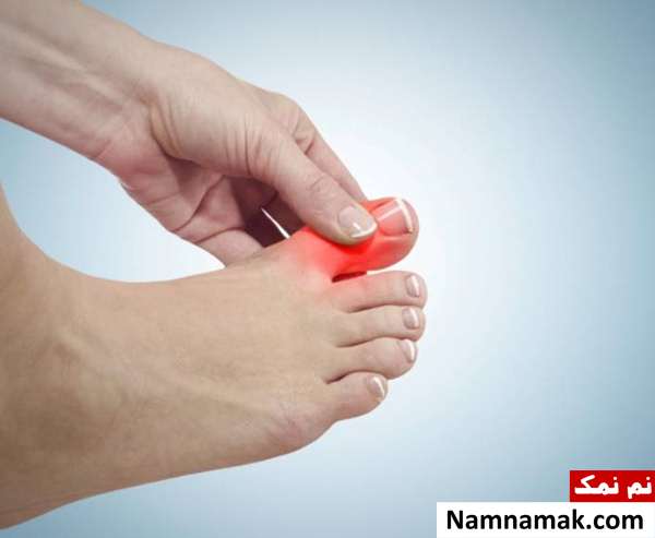 شکل پاها تشخیص بیماری از روی شکل پا