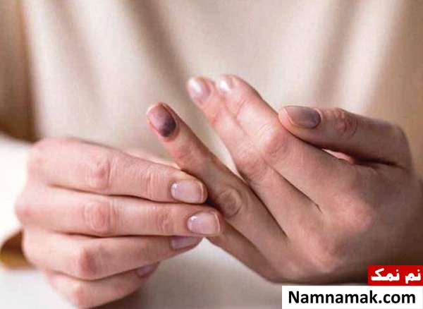 تست سلامت بدن با فشار دادن ناخن