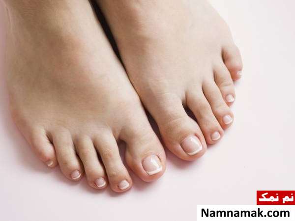 پای سیندرلایی خطرات جراحی پای سیندرلا