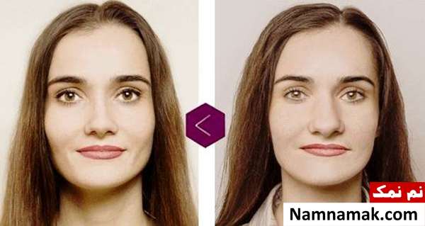 اصلاح نوک بینی