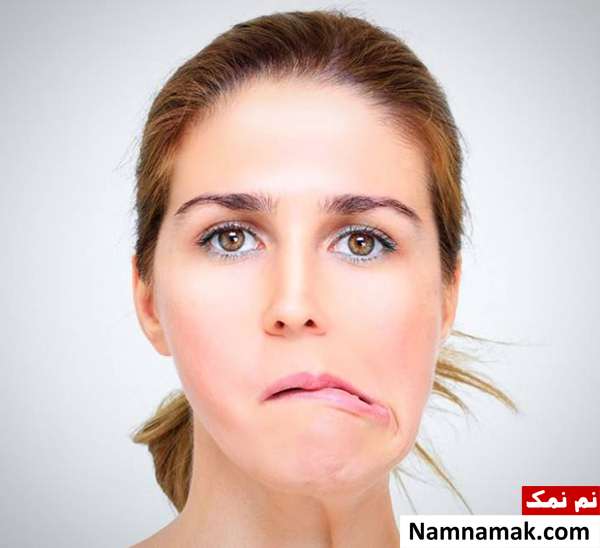 علائم فلج صورت