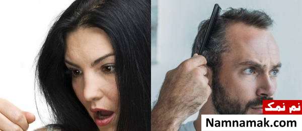 ریزش موی زنان و دختران جوان چگونه درمان می شود؟ ریزش مو زنان