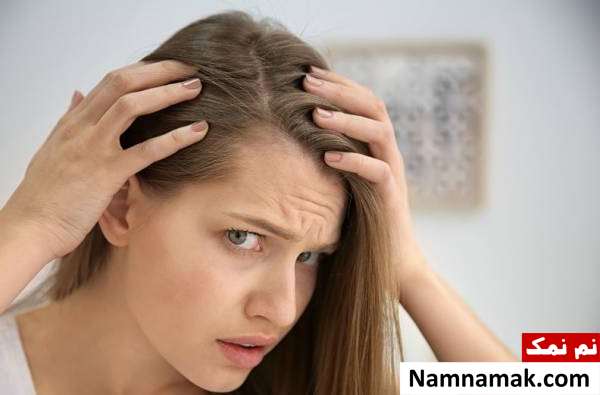 ریزش موی زنان و دختران جوان چگونه درمان می شود؟ ریزش موی زنانه