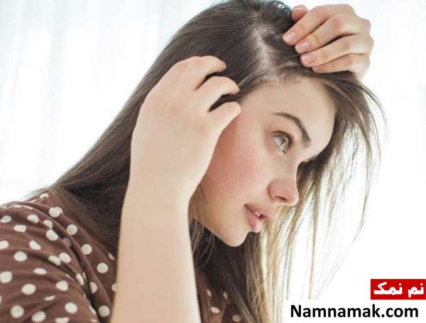 ریزش موی زنان و دختران جوان چگونه درمان می شود؟ ریزش مو بانوان