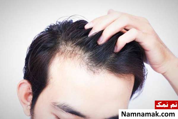 روغن سیاه دانه برای رشد مجدد موهای ریخته + دستور سیاه دانه برای مو