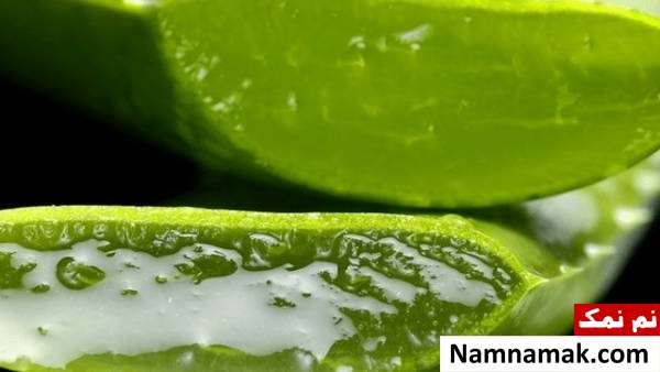 8 روش فوق العاده برای درمان ریزش موی شقیقه ها در زنان و مردان درمان ریزش مو با آلوئه ورا
