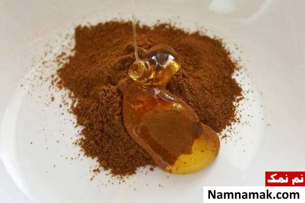 8 روش فوق العاده برای درمان ریزش موی شقیقه ها در زنان و مردان درمان ریزش مو با عسل و دارچین