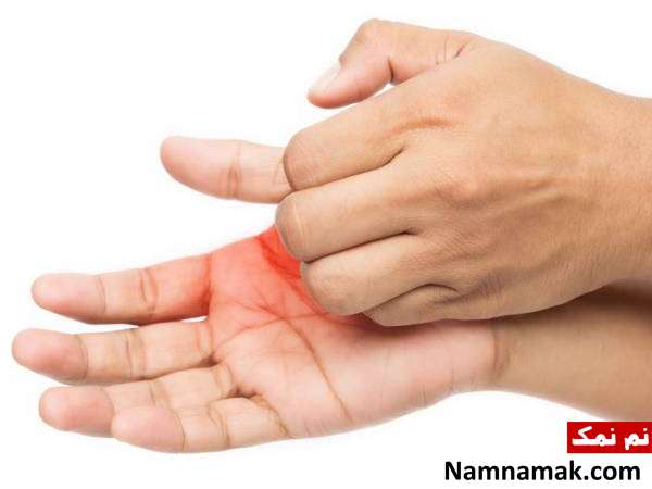 علل و علائم نوروپاتی + درمان های طبیعی بیماری اعصاب محیطی بیماری نوروپاتیک