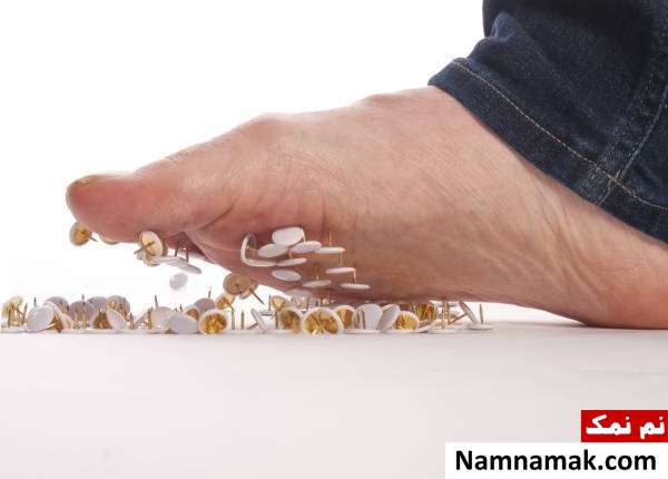 علل و علائم نوروپاتی + درمان های طبیعی بیماری اعصاب محیطی عوامل خطر نوروپاتی
