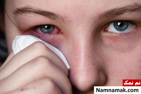 مشکلات چشم در کرونا