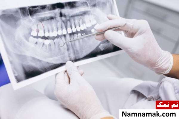 تاثیر عکس دندان در شیردهی