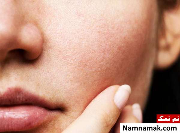 برای پوست دوش آب سرد بهتره یا آب گرم؟ خواص دوش آب سرد برای منافذ پوست