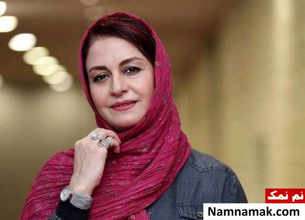 مریلا زارعی بازیگری که عمل زیبایی نداشته