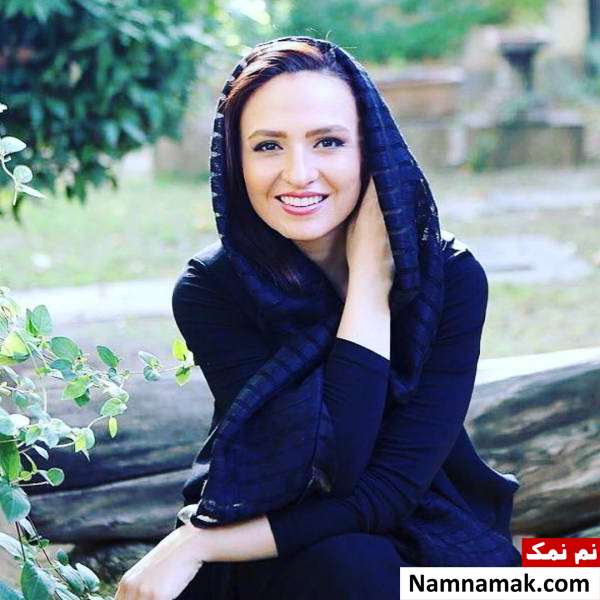 گلاره عباسی بازیگر بدون عمل زیبایی