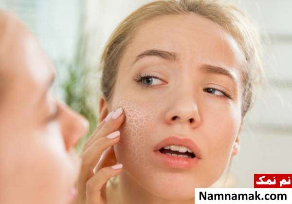 راه هایی برای درمان خشکی پوست