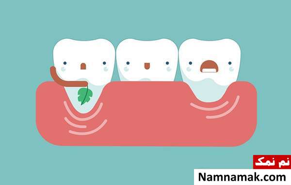 علائم مخفی پوکی استخوان چیست؟ علائم مخفی پوکی استخوان چیست؟