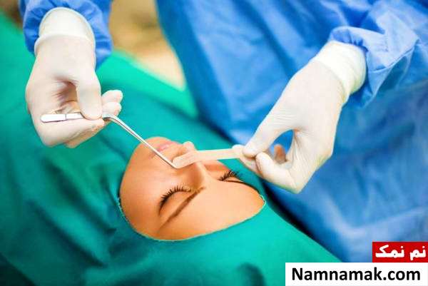 جراحی انحراف بینی یا سپتوپلاستی برای کی لازمه؟ روش عمل جراحی سپتوم بینی