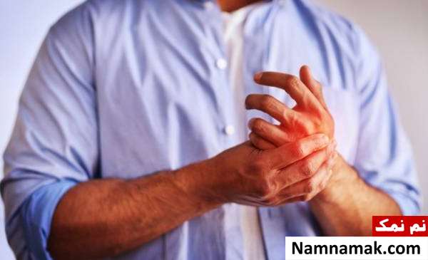 مشکلات اعصاب در بیماری شوگرن