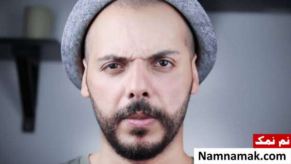بهترین کلاه بعد از کاشت مو