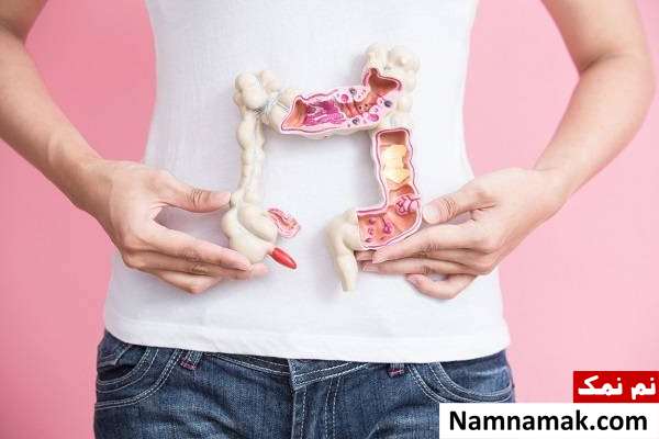 همه چیز درباره سندرم لینچ ، از علل و علائم تا درمان و عوارض تشخیص سرطان کولون