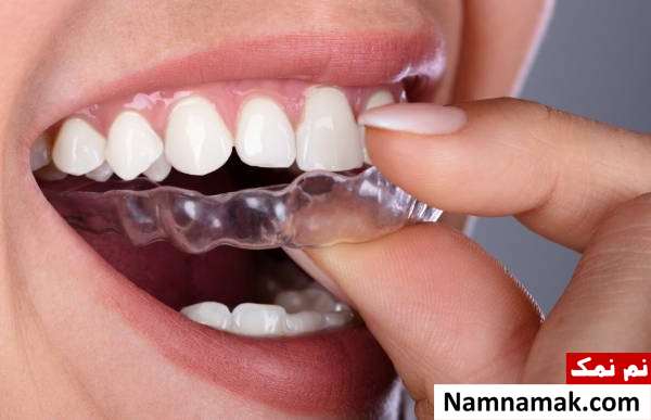 تمام آنچه باید درباره نایت گارد بدانید