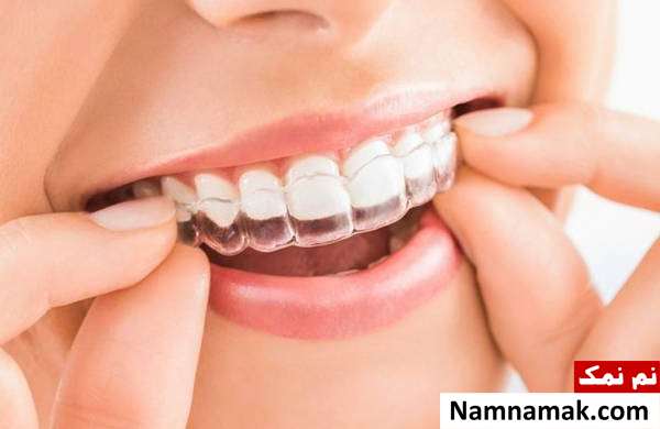 نایت گارد برای محافظت از مینای دندان